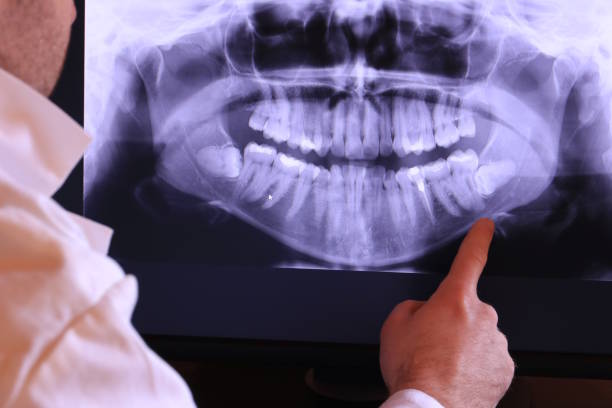 Best Orthodontic Emergency Dentist in Holmes Beach, FL